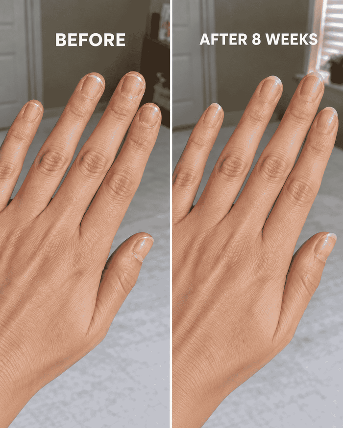 Caroline D., 58 - adapting to nails that changed over time