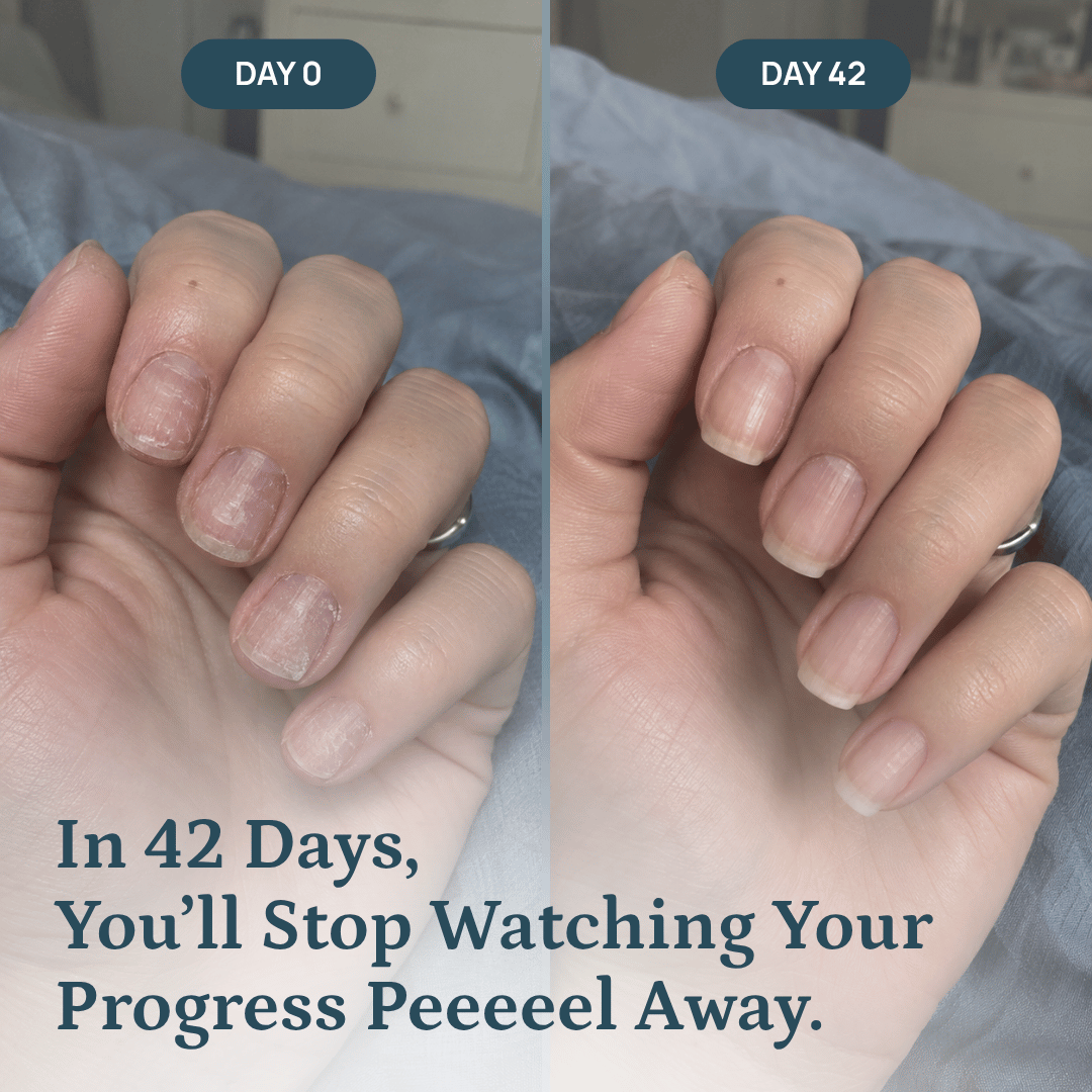 Nail Repair Serum