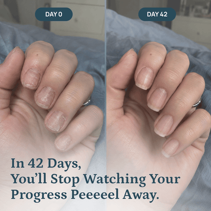 Nail Repair Serum